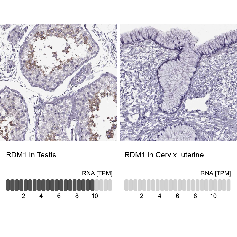 Anti-RDM1 Antibody