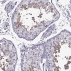 Immunohistochemical staining of human testis shows high expression.