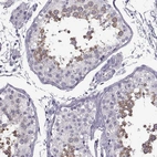 Immunohistochemical staining of human testis shows high expression.