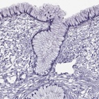 Immunohistochemical staining of human cervix, uterine shows low expression as expected.