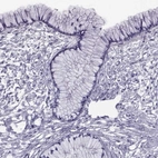 Immunohistochemical staining of human cervix, uterine shows low expression as expected.