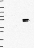 Anti-IL7R Antibody