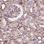 Anti-ANP32A Antibody