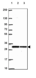 Lane 1: Marker [kDa] 250, 130, 95, 72, 55, 36, 28, 17, 10_br/_Lane 2: Human cell line RT-4_br/_Lane 3: Human cell line U-251 MG