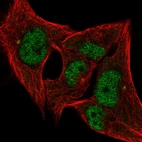 Immunofluorescent staining of human cell line SK-MEL-30 shows localization to nucleoplasm & centrosome.