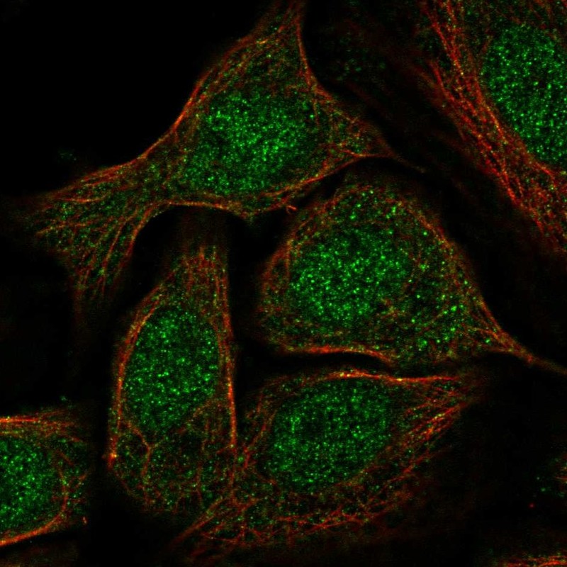 Anti-GATA5 Antibody