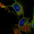 Immunofluorescent staining of human cell line U-251 MG shows localization to plasma membrane & endoplasmic reticulum.