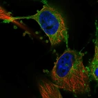 Immunofluorescent staining of human cell line U-251 MG shows localization to plasma membrane & endoplasmic reticulum.
