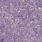 Immunohistochemical staining of human lymph node shows high expression.