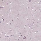 Immunohistochemical staining of human cerebral cortex shows low expression as expected.