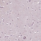 Anti-SLAMF8 Antibody
