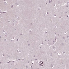 Immunohistochemical staining of human cerebral cortex shows low expression as expected.
