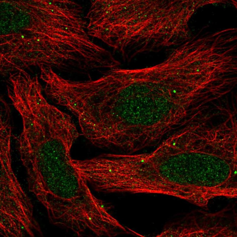 Anti-SLC30A3 Antibody