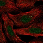 Anti-SLC30A3 Antibody