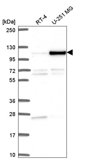 Anti-NOC3L Antibody