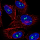 Immunofluorescent staining of human cell line U-251 MG shows localization to nucleoli.