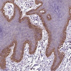 Anti-NUDT2 Antibody
