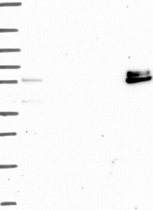 Anti-ADAMTS16 Antibody