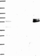 Anti-ADAMTS16 Antibody