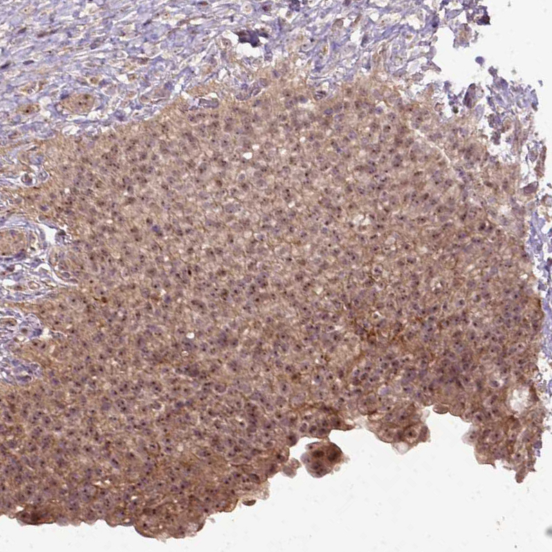 Anti-PARP3 Antibody