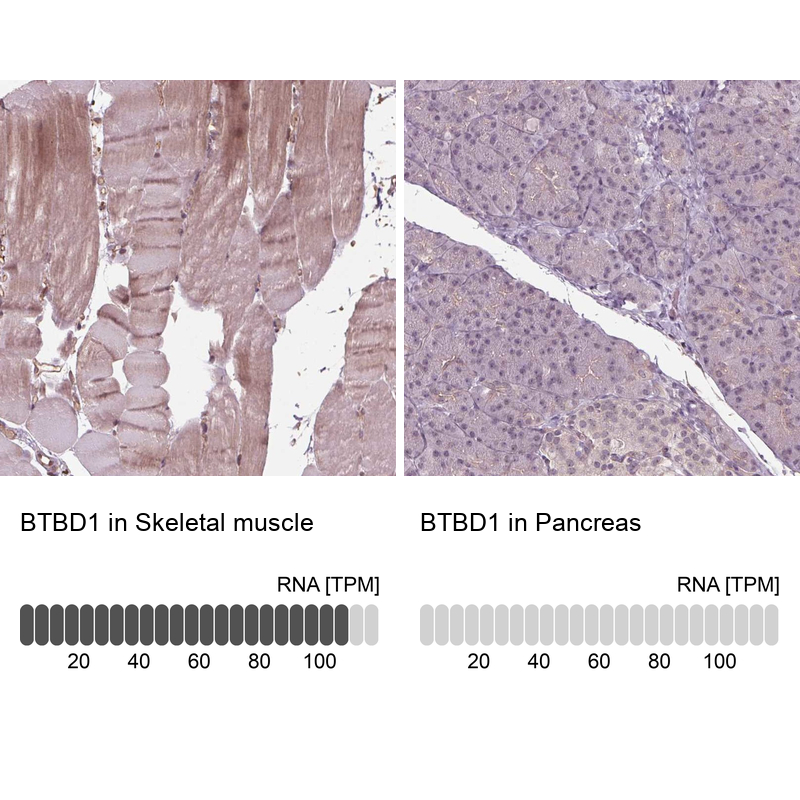 Anti-BTBD1 Antibody