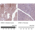 Anti-BTBD1 Antibody