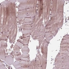 Immunohistochemical staining of human skeletal muscle shows high expression.
