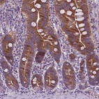 Anti-ATG4D Antibody