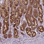 Anti-ILVBL Antibody