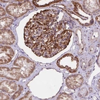 Anti-CYYR1 Antibody