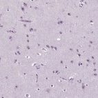 Anti-ZNF853 Antibody