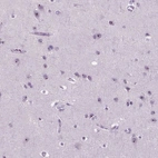 Anti-ZNF853 Antibody