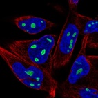 Immunofluorescent staining of human cell line RH-30 shows localization to nucleoli.