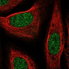Immunofluorescent staining of human cell line U-2 OS shows localization to nucleoplasm.