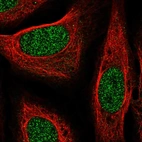 Immunofluorescent staining of human cell line U-2 OS shows localization to nucleoplasm.
