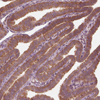 Immunohistochemical staining of human fallopian tube shows strong cytoplasmic positivity in glandular cells.