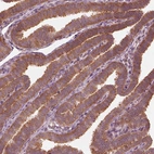 Immunohistochemical staining of human fallopian tube shows strong cytoplasmic positivity in glandular cells.