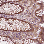 Immunohistochemical staining of human rectum shows moderate cytoplasmic positivity in glandular cells.