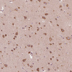 Immunohistochemical staining of human cerebral cortex shows strong cytoplasmic positivity in neurons.