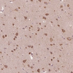 Immunohistochemical staining of human cerebral cortex shows strong cytoplasmic positivity in neurons.
