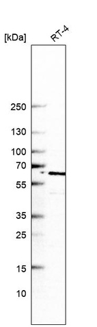 Western blot analysis in human cell line RT-4.