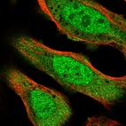 Immunofluorescent staining of human cell line U-2 OS shows localization to nucleoplasm & cytosol.