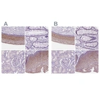Immunohistochemical staining of human cervix, uterine, gastrointestinal, kidney and skin using Anti-SBSN antibody HPA067734 (A) shows similar protein distribution across tissues to independent antibody HPA062568 (B).