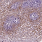 Immunohistochemical staining of human esophagus shows moderate membranous positivity in squamous epithelial cells.