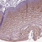 Immunohistochemical staining of human skin shows moderate membranous positivity in squamous epithelial cells.
