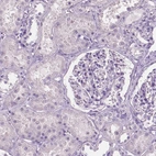 Immunohistochemical staining of human kidney shows no positivity in cells in glomeruli as expected.
