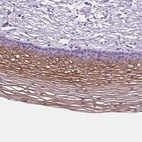 Immunohistochemical staining of human cervix, uterine shows moderate membranous positivity in squamous epithelial cells.