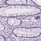 Immunohistochemical staining of human rectum shows no positivity in glandular cells as expected.