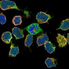 Immunofluorescent staining of human cell line JURKAT shows localization to plasma membrane.