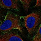 Immunofluorescent staining of human cell line U-2 OS shows localization to plasma membrane.